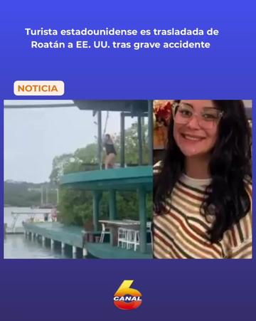 @Canal Seis Honduras