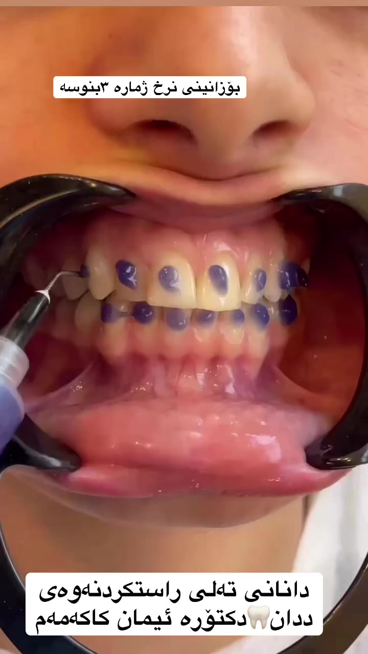 @🦷 دکتۆرە ئیمان کاکەمەم
