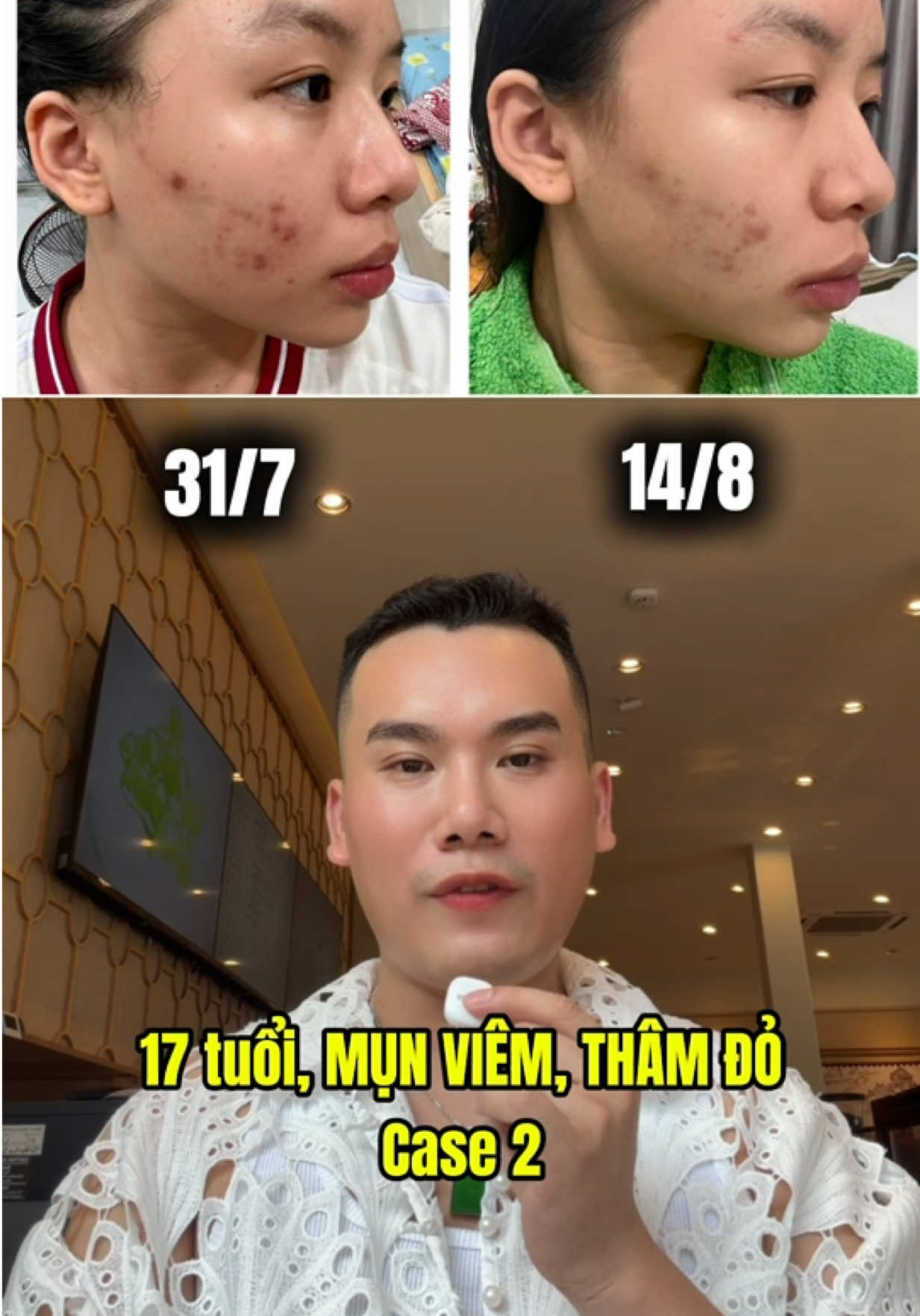 @Cô Học Chăm Da