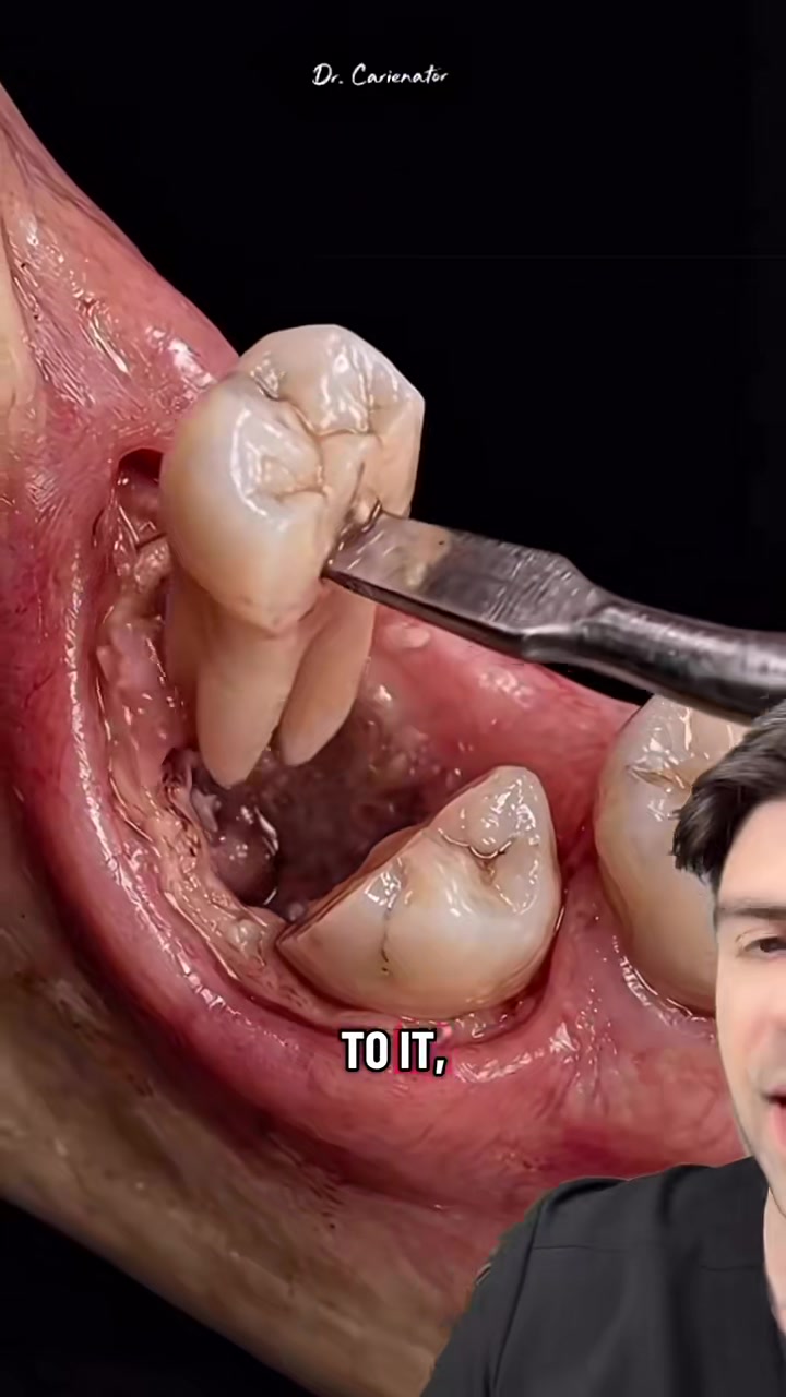 @Dr. Kadish