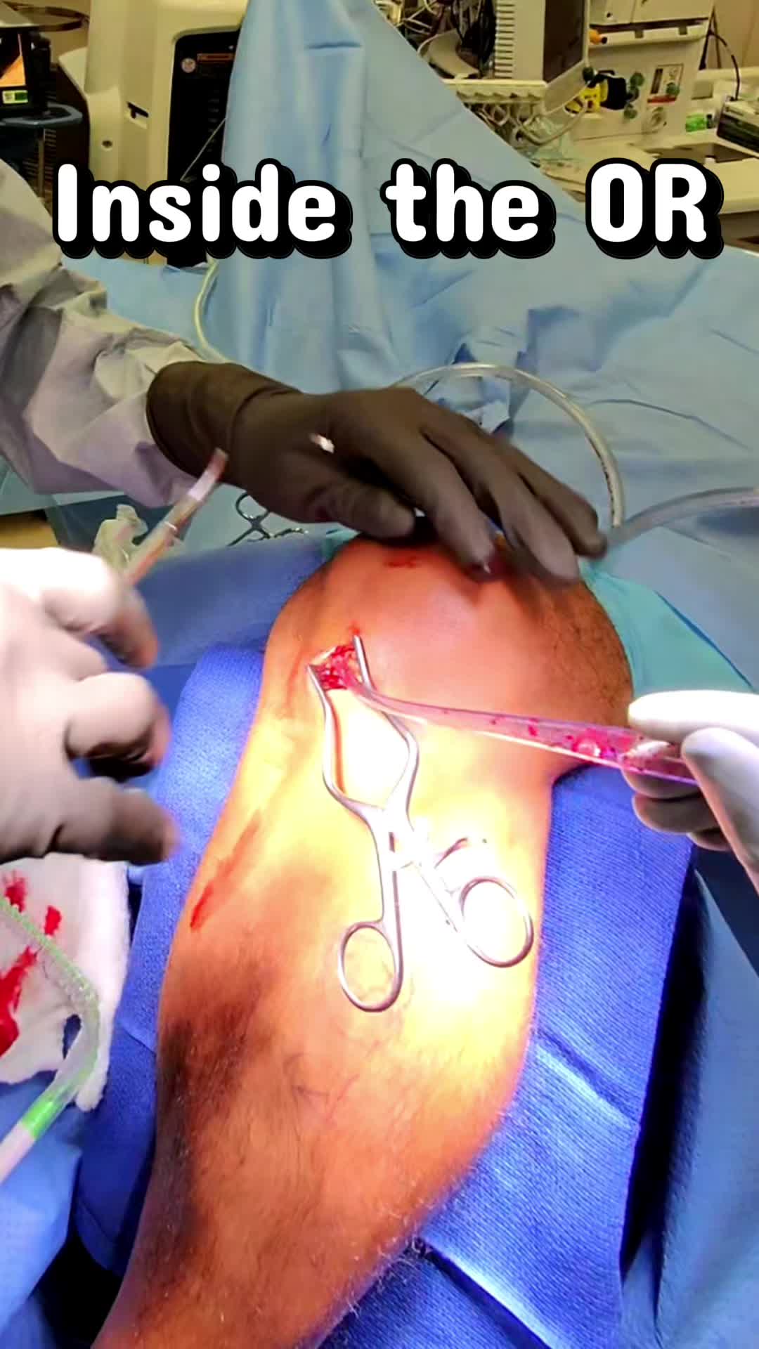 @Ortho POV