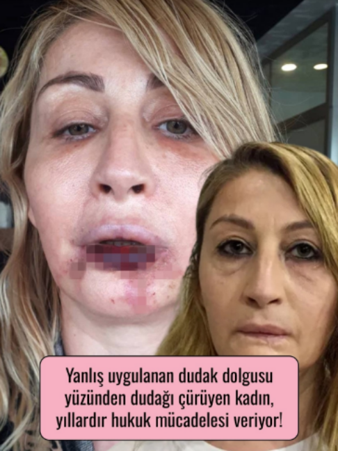 @Mynet Kadin