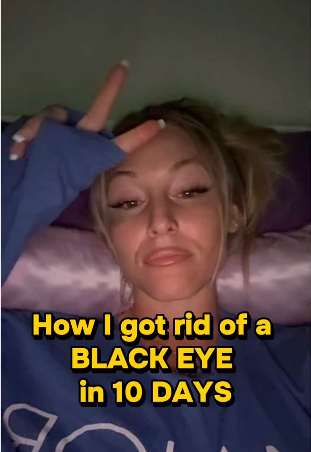@Alex Major