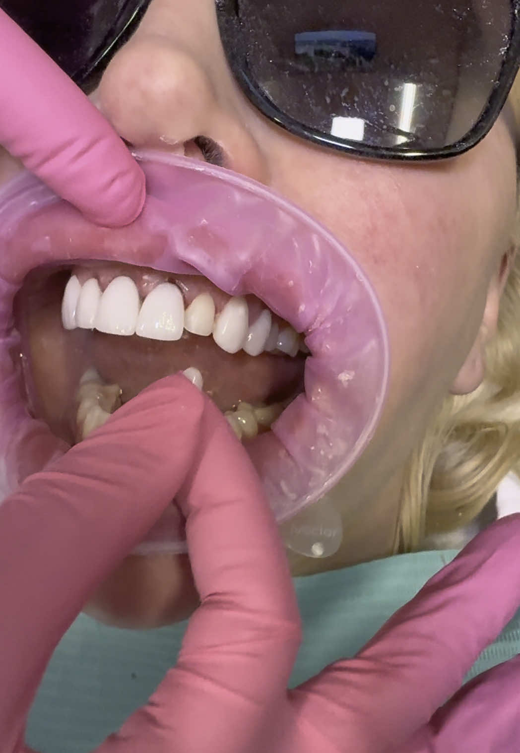 @Scottsdale Smile Specialist