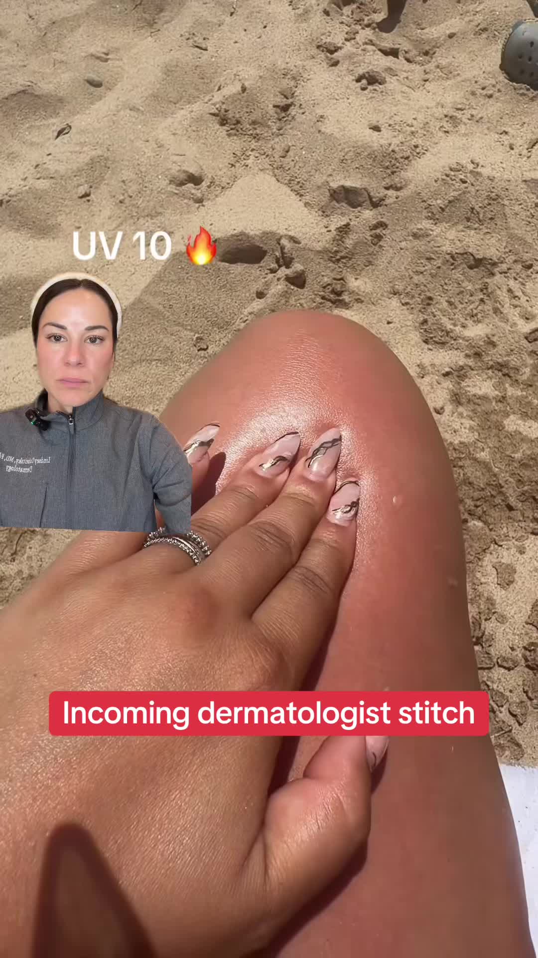 @Dermguru