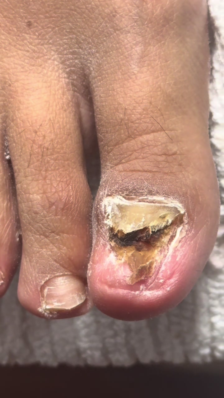 @ToesbyKoki