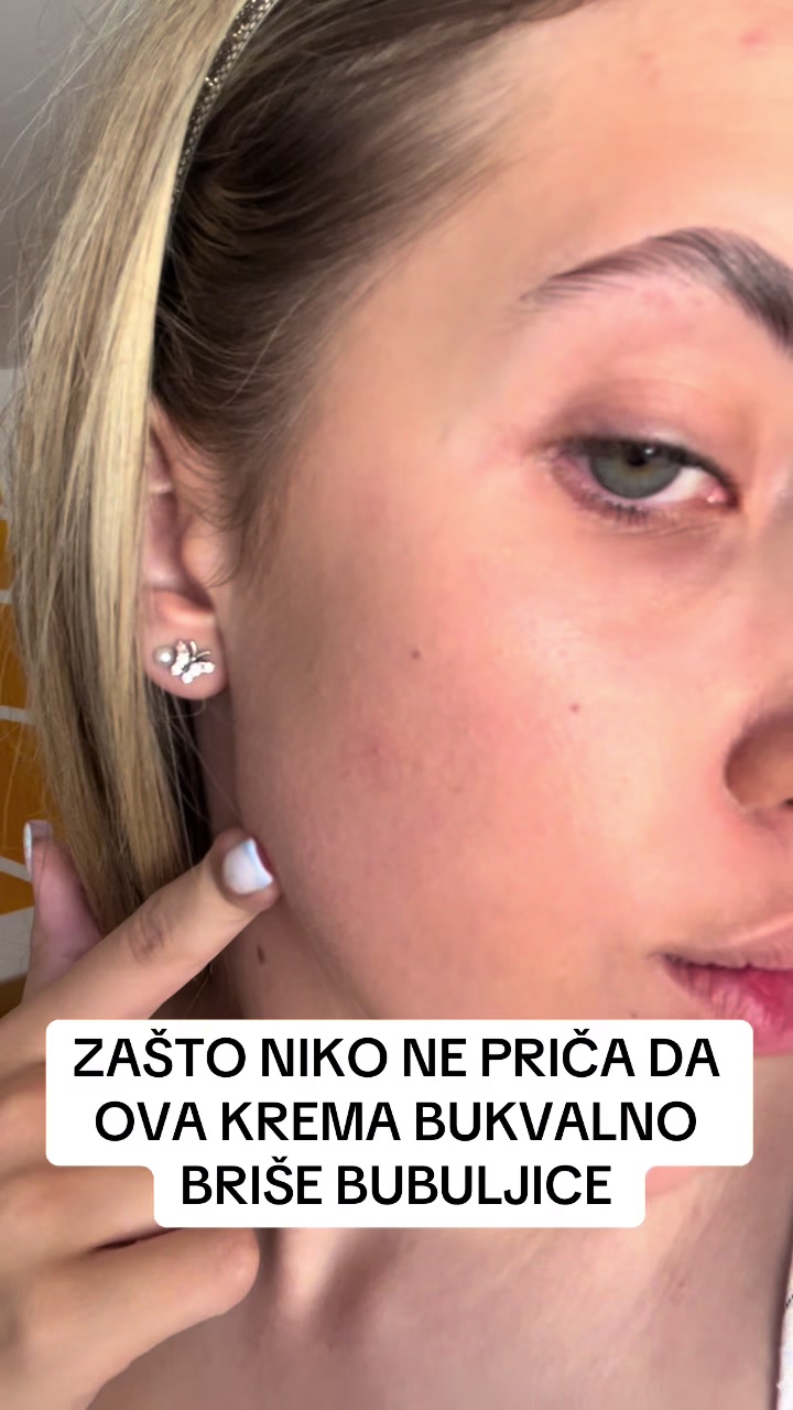 @obrisii.flekice