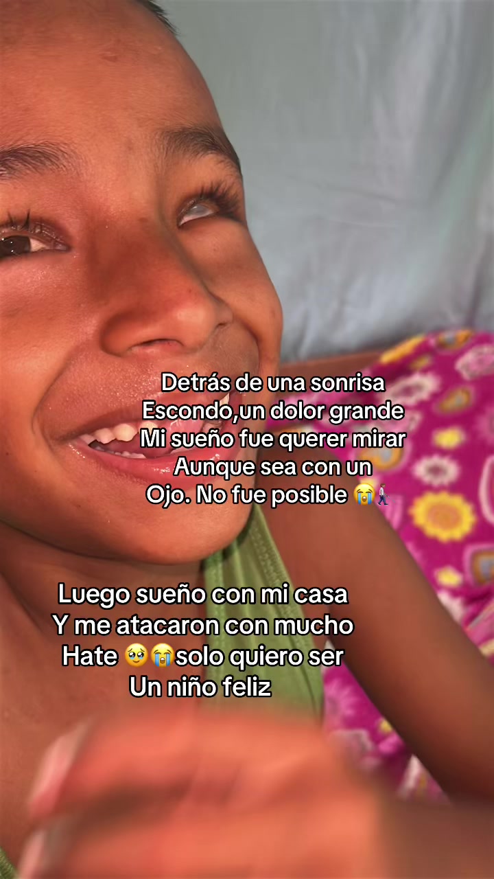 @👨🏽🦯➡️Dilan niño ciego💧