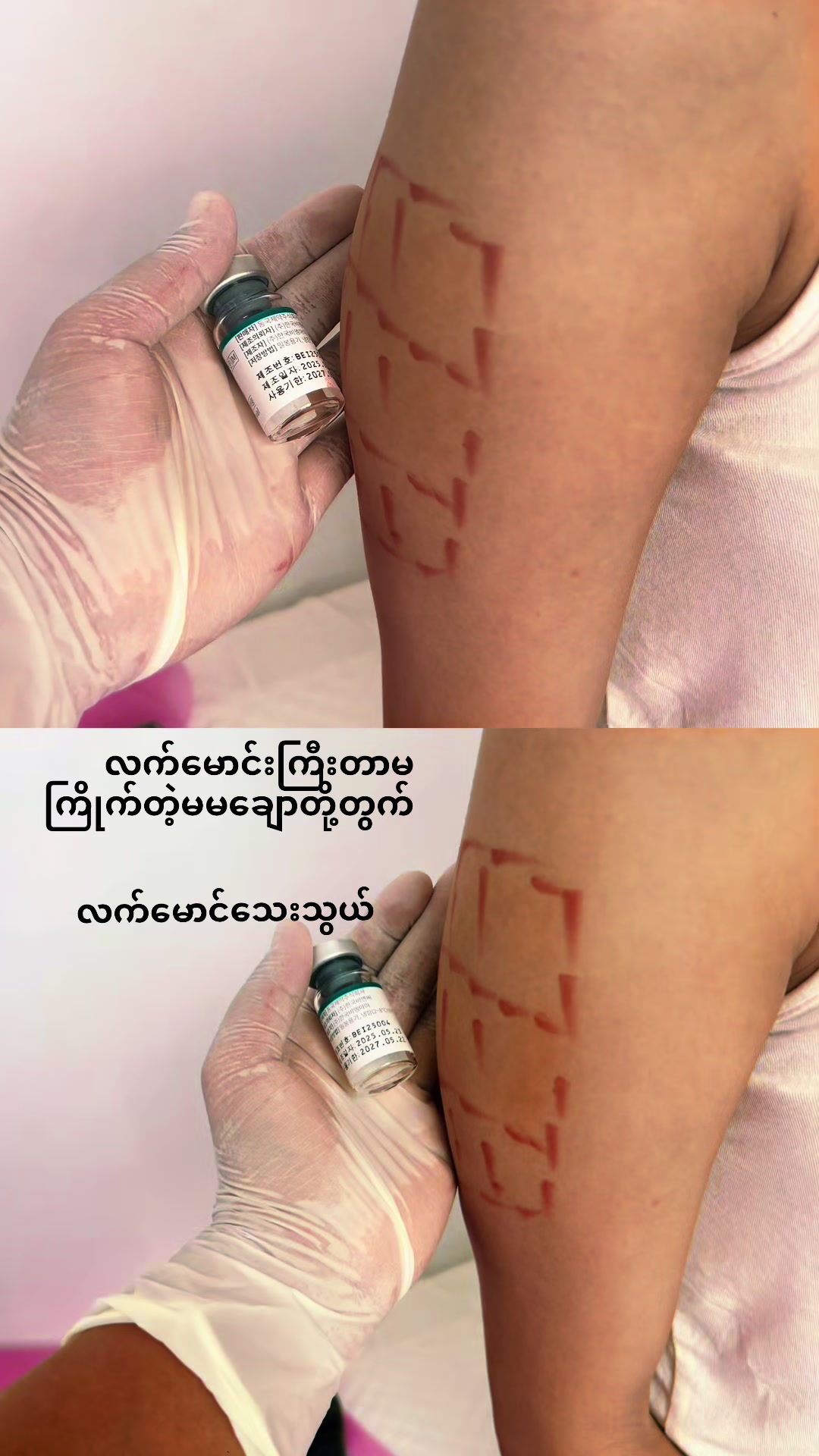 @JaJa (April Nu Beauty Clinic)