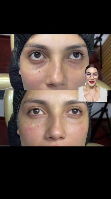 @Tu Armonizadora💉💜Chiclayana