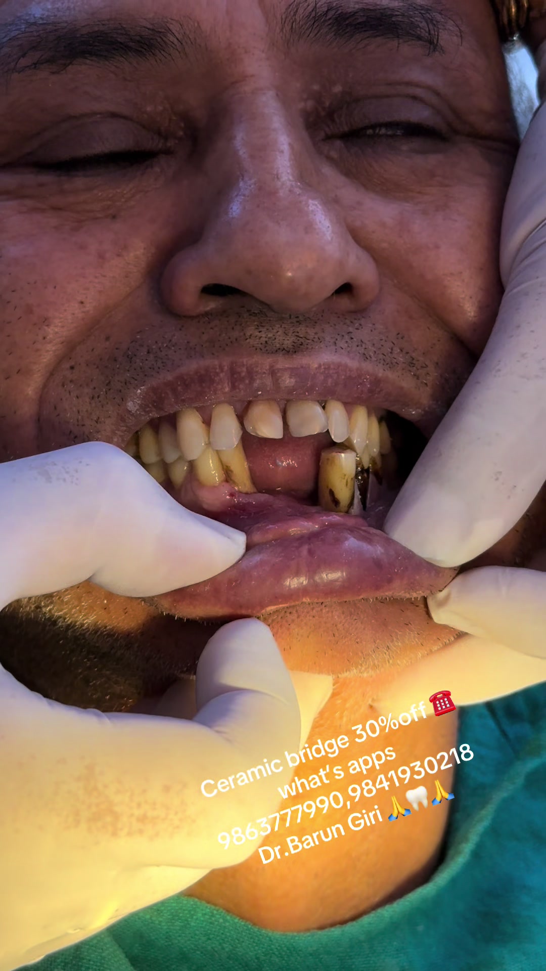 @Unique dental clinic Chabahil