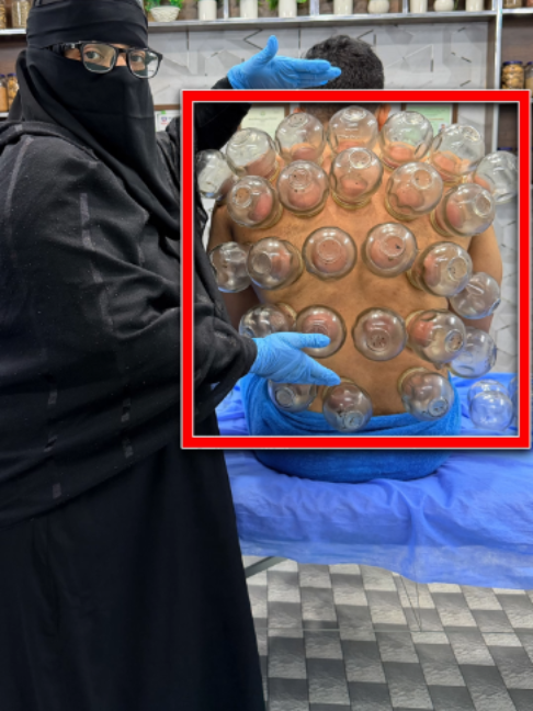 @Doctor & Hijama Cupping Clinic