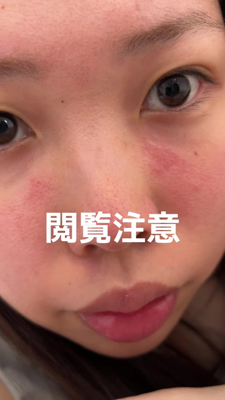 @アカネマディ