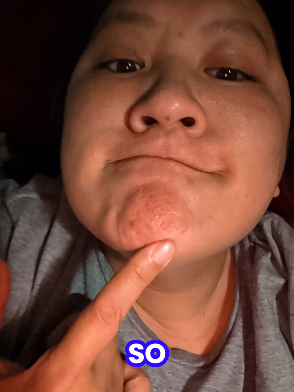 @ChubbySnorlax03