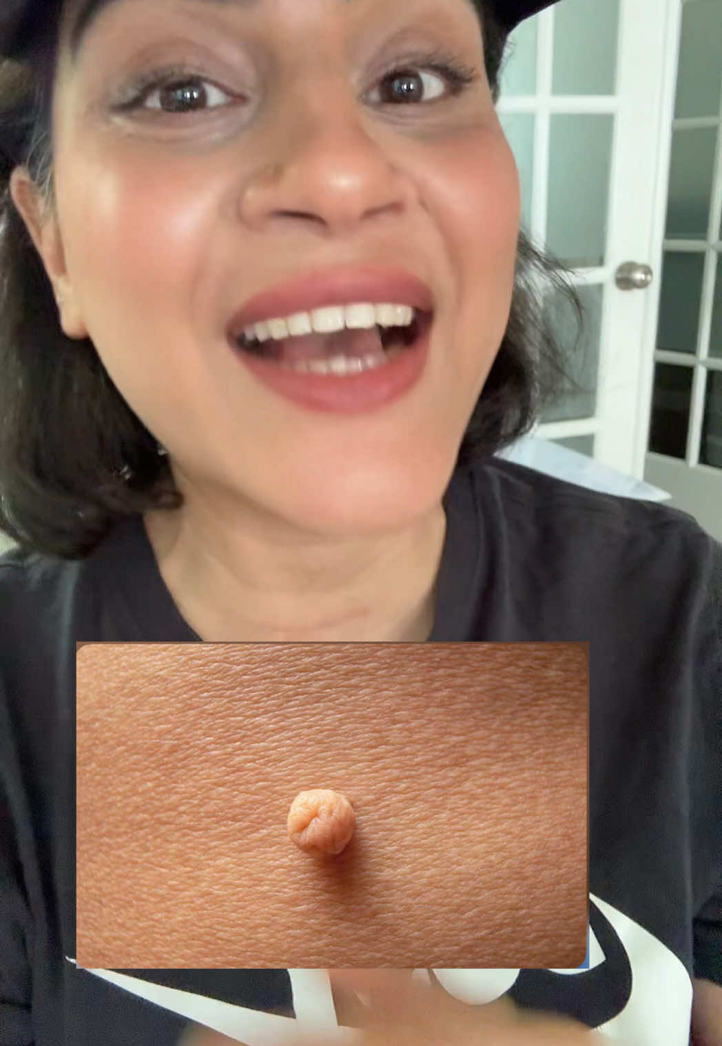 @Mona Aslam | Gut & Glow Coach