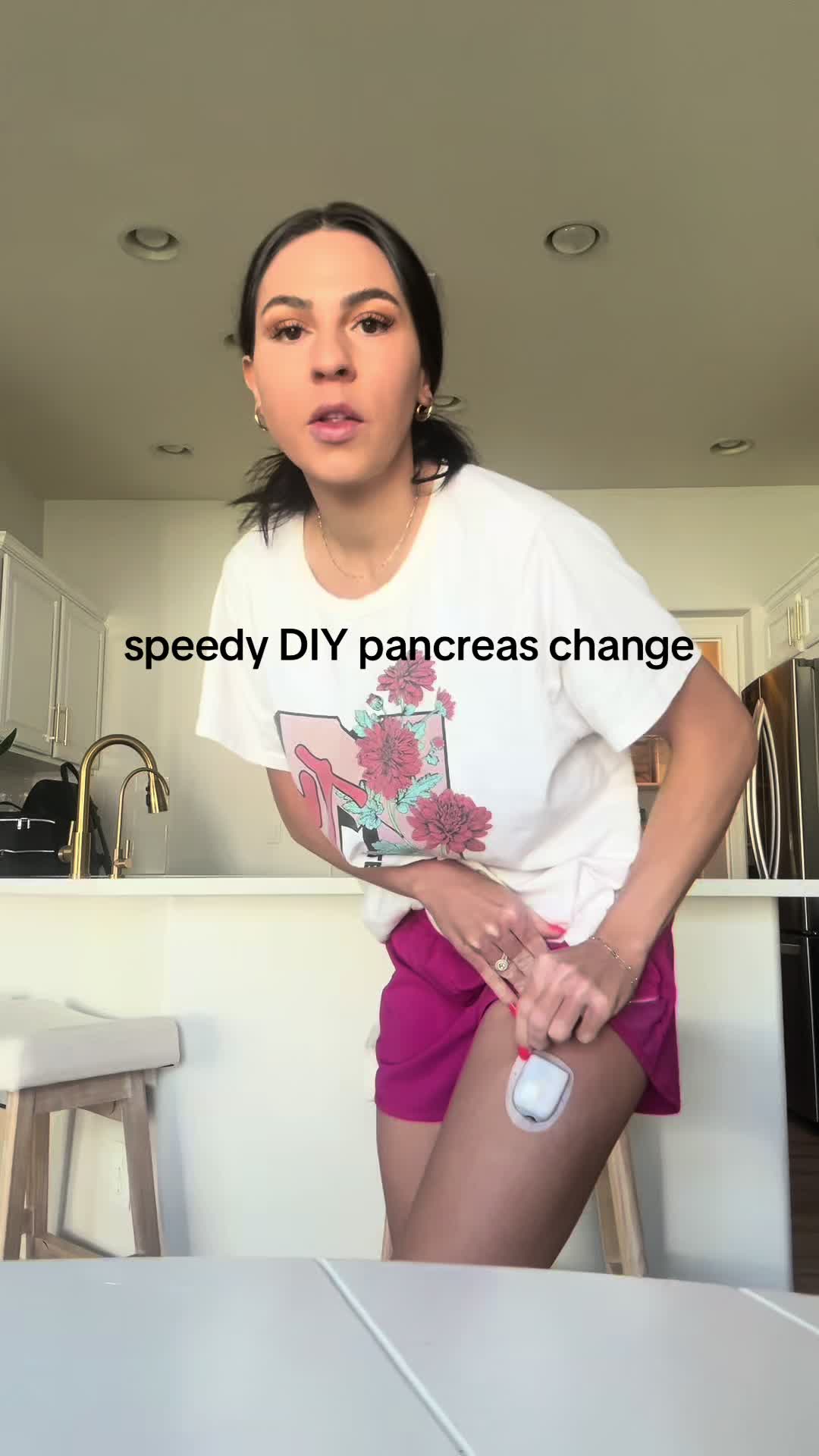 @Addy Tayler | T1D
