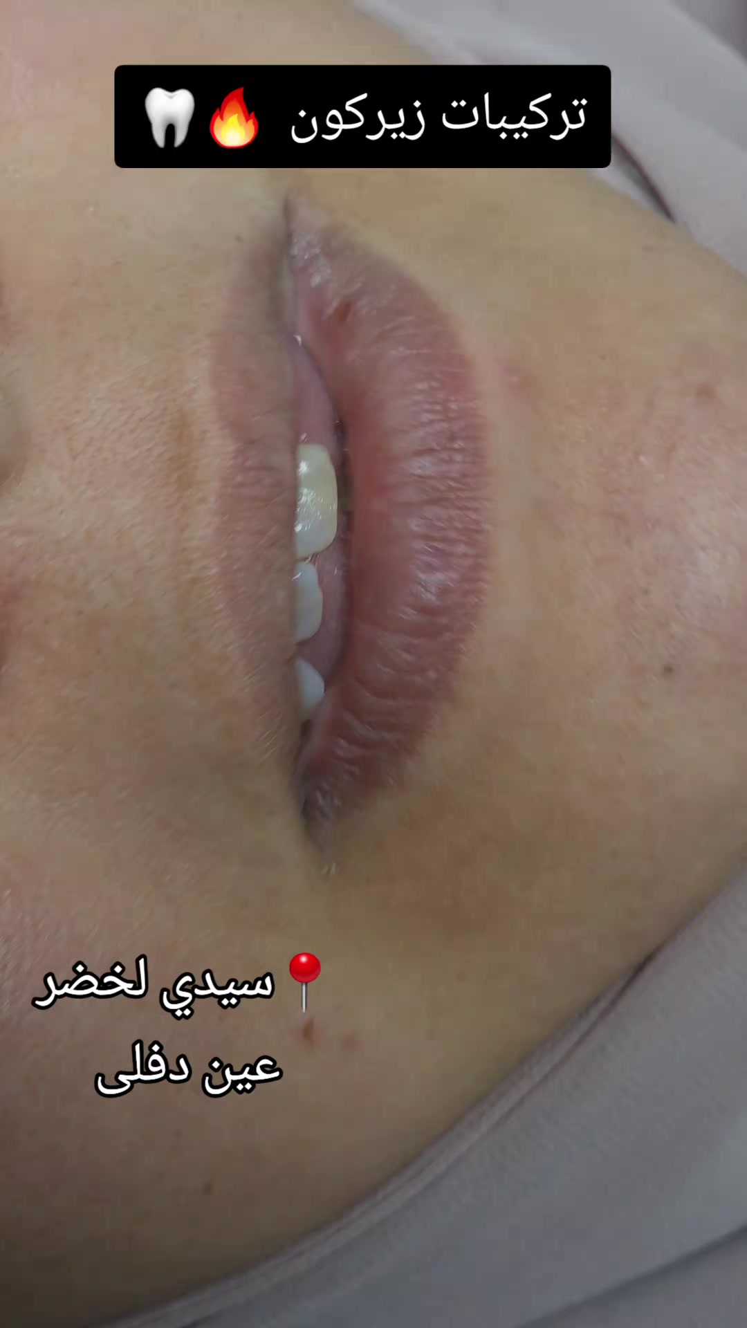 @Dr otmani. A 🦷🖤