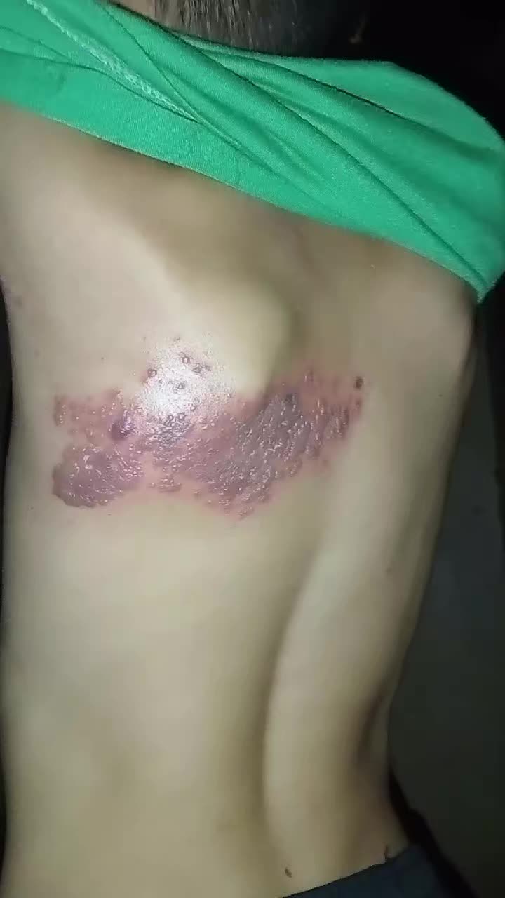 @cila95