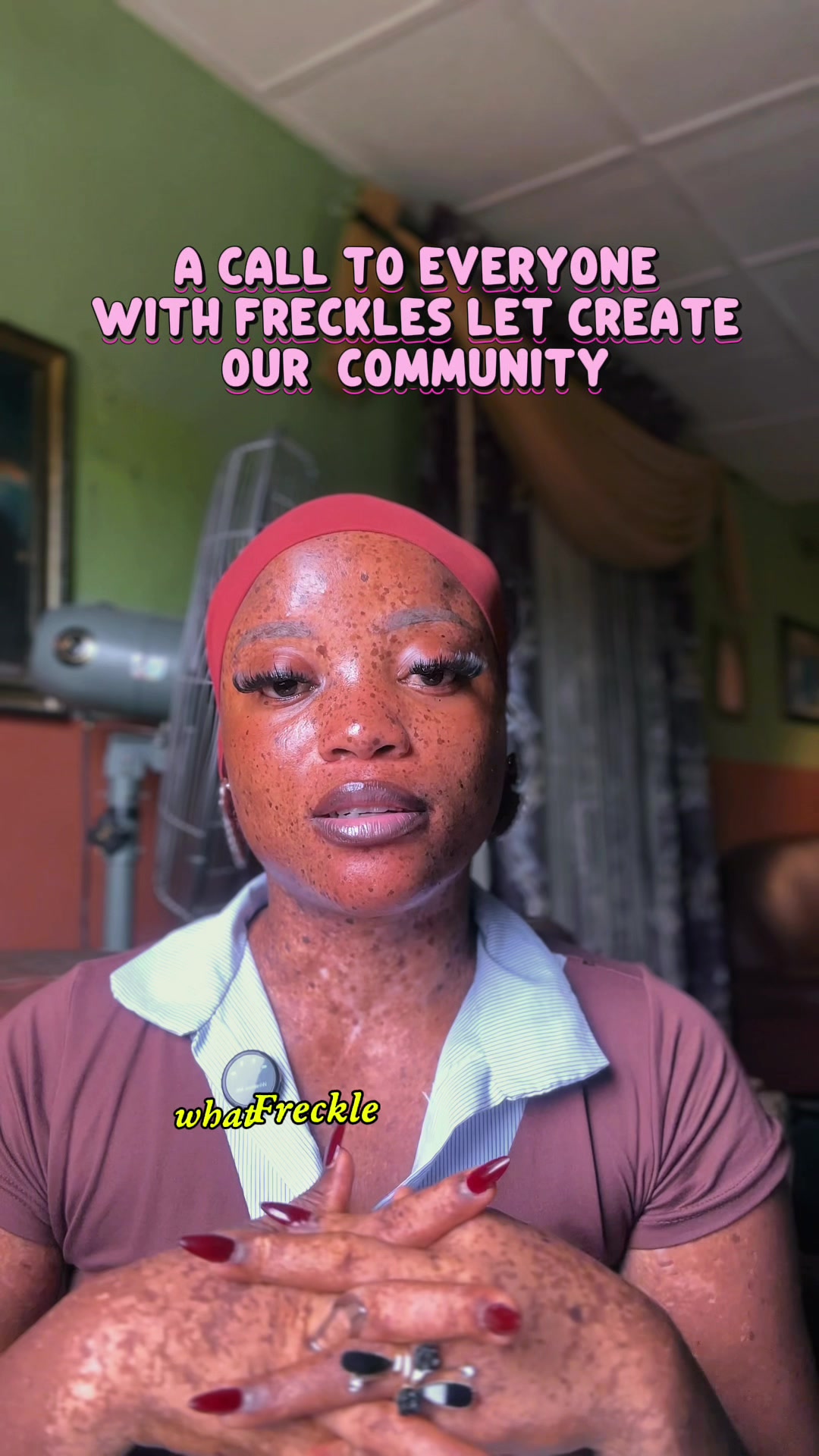 @The freckles girl