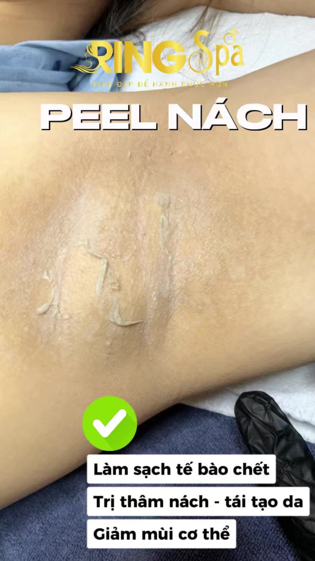 @Ring_Spa