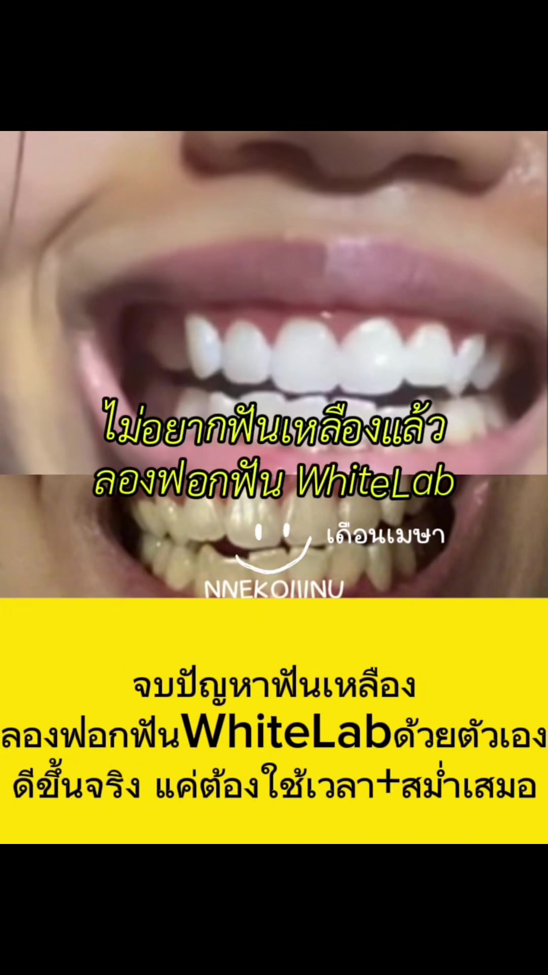 @NNEkOIINUใช้แล้วดี