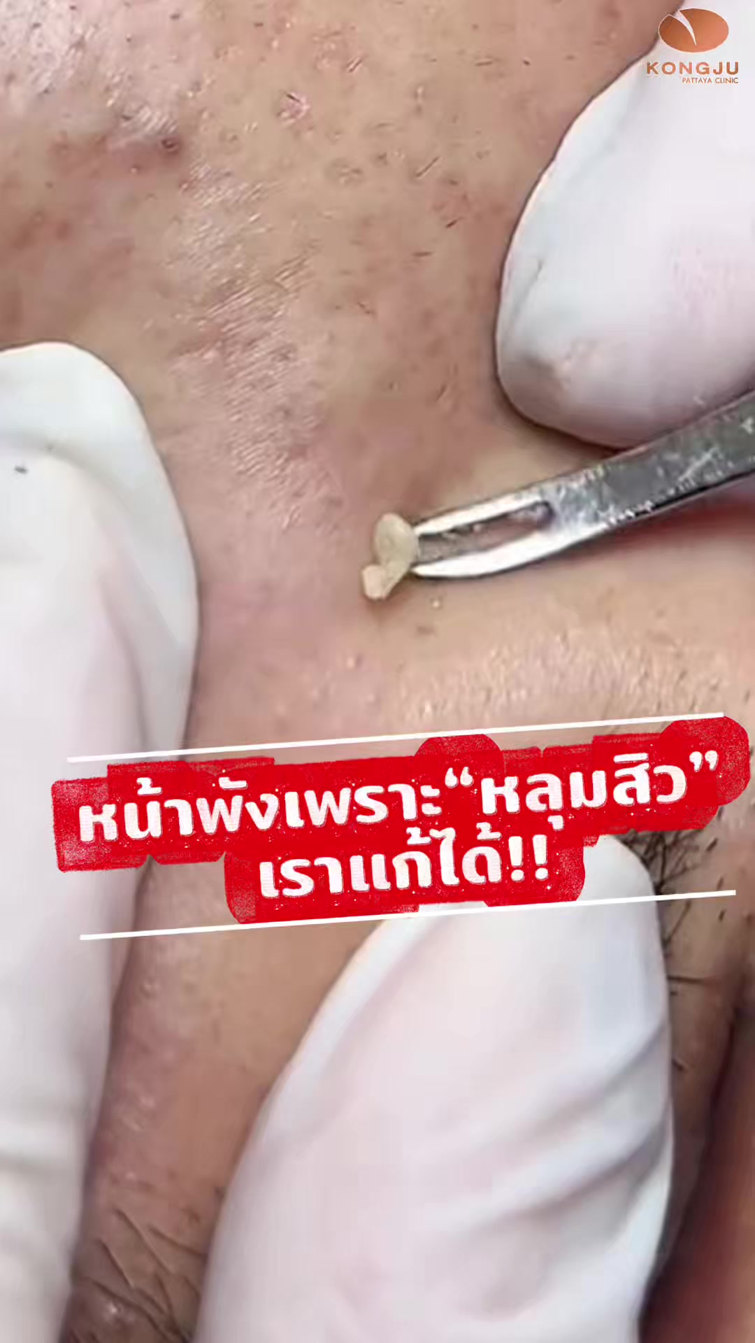 @กองจู พัทยา