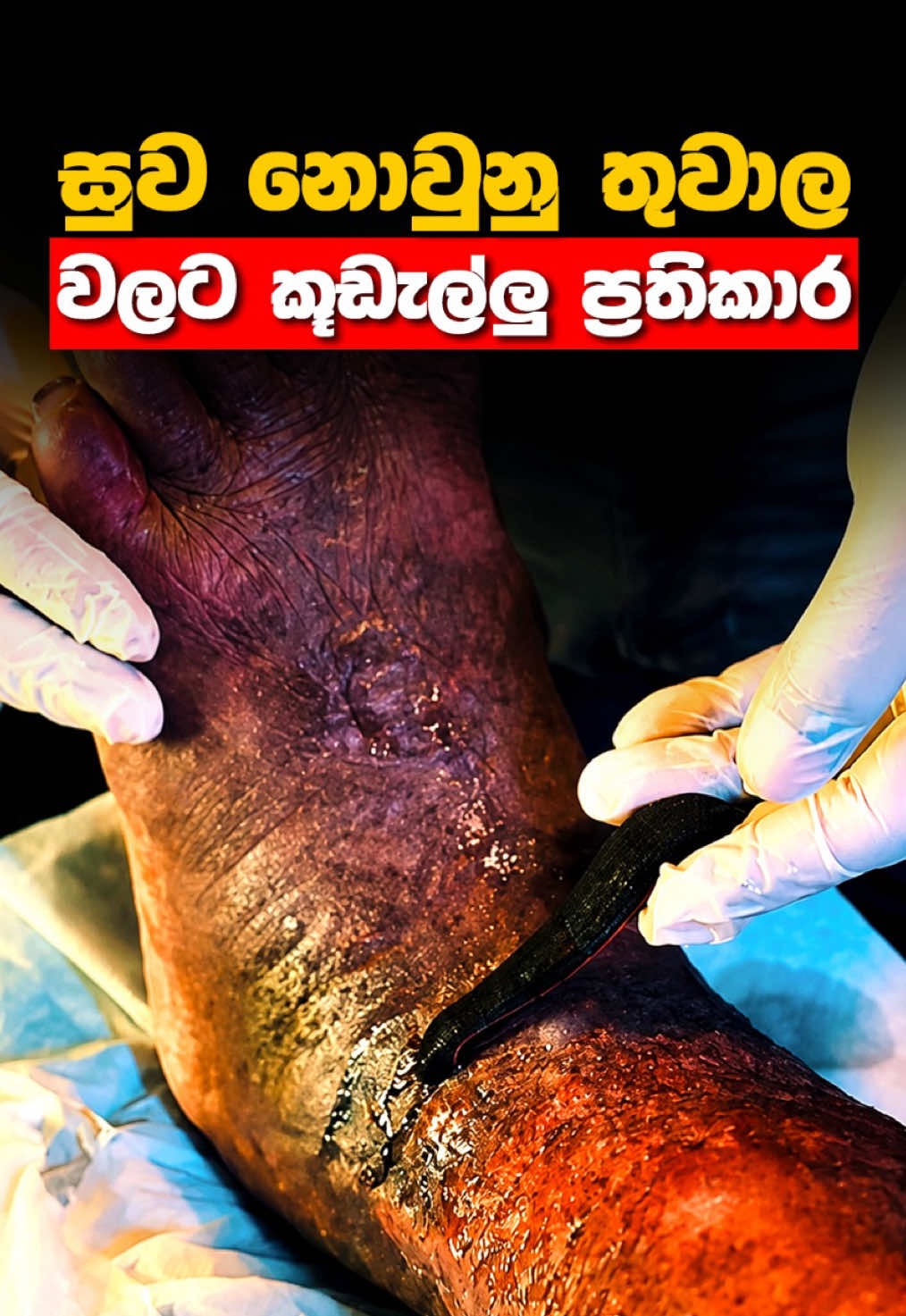 @Ceylon Hospital | Ayurveda