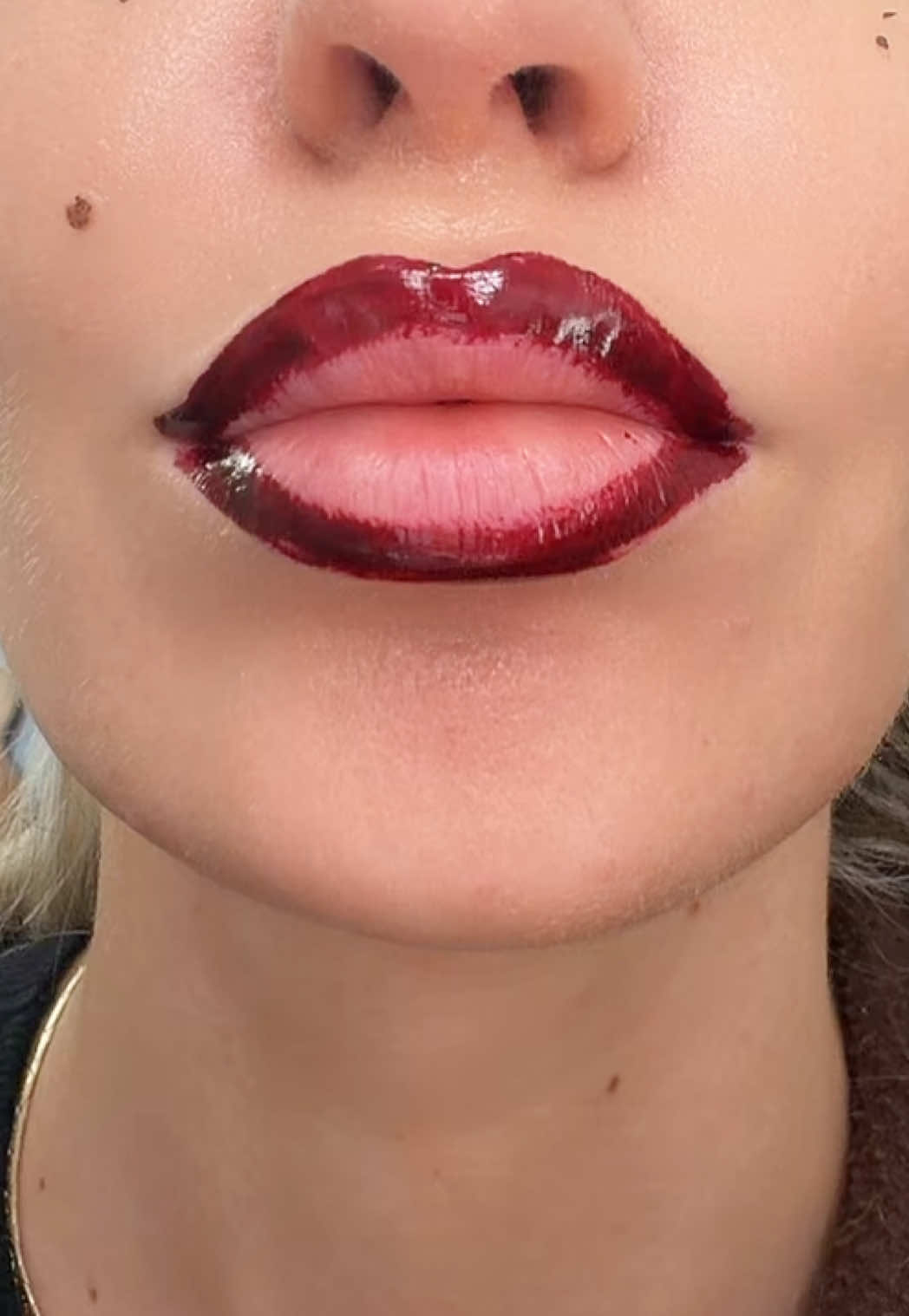 @Teddyxo