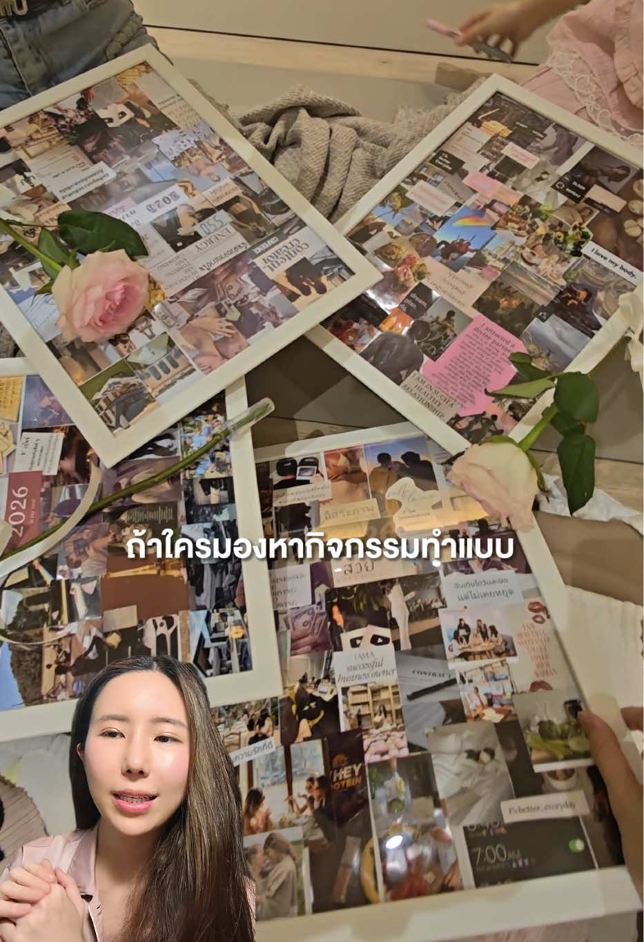 @หมอป่องสวยมาก veneer 🦷