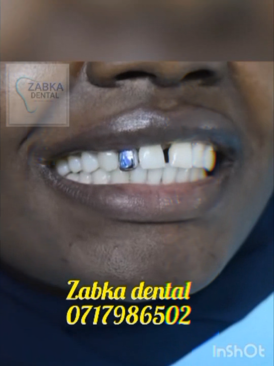 @Zabka Dental