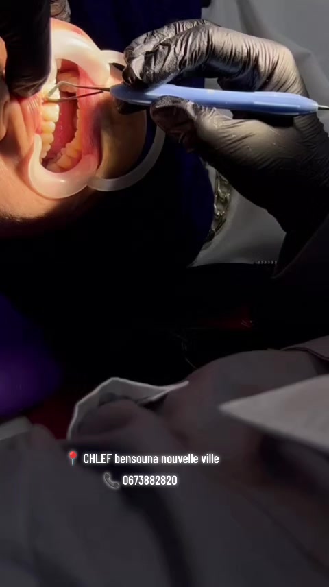 @Dr HASSOUN02 طبيبة الاسنان شلف