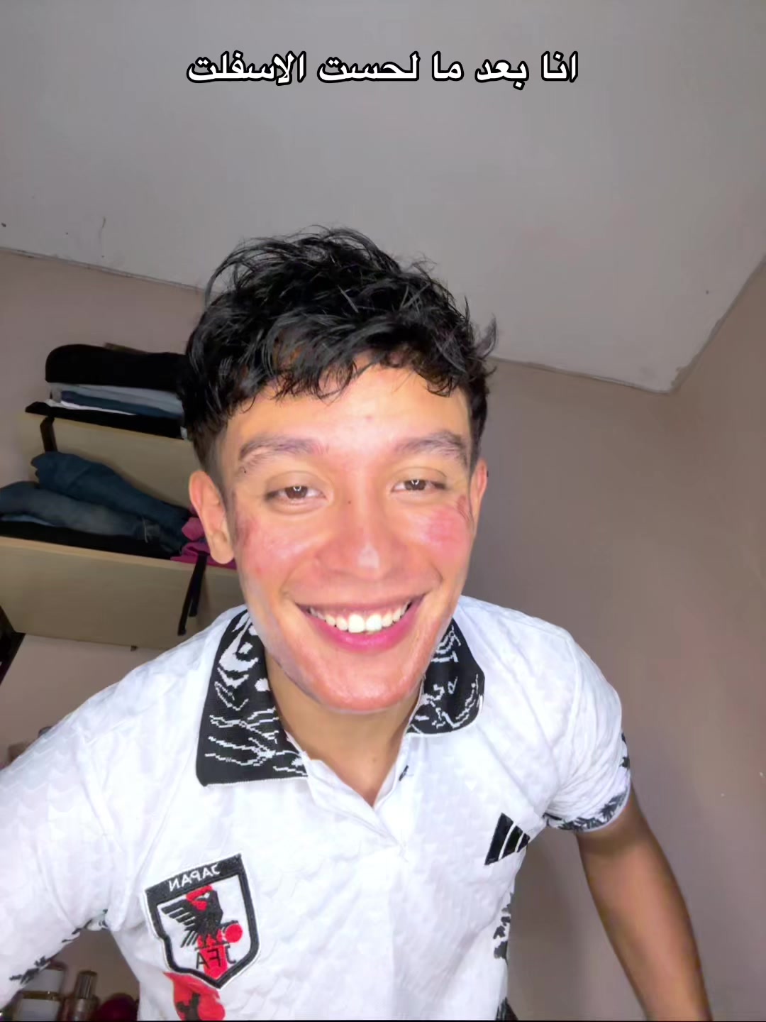 @سامر الفلبيني🇵🇭