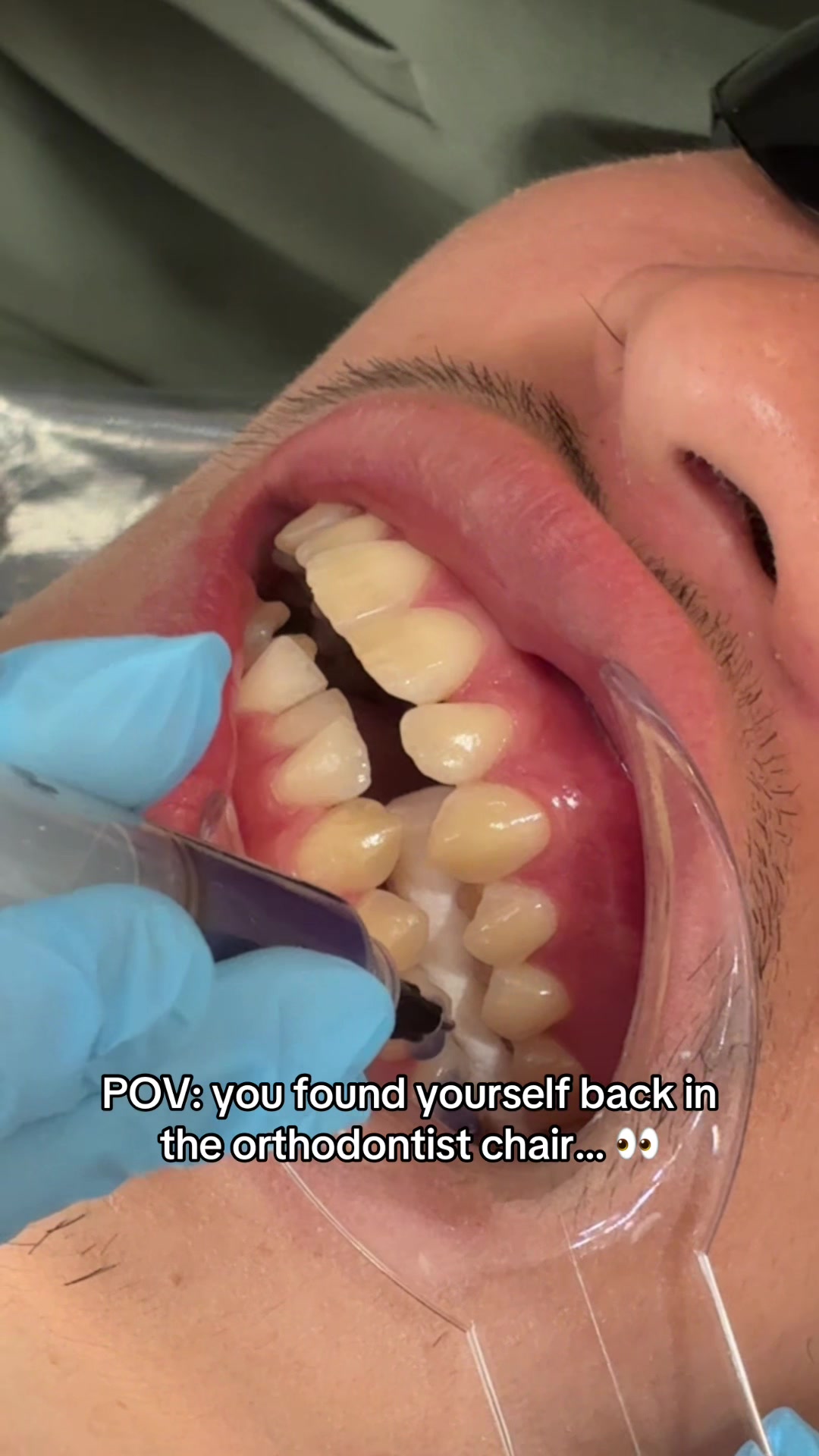 @Woodland Hills Orthodontist
