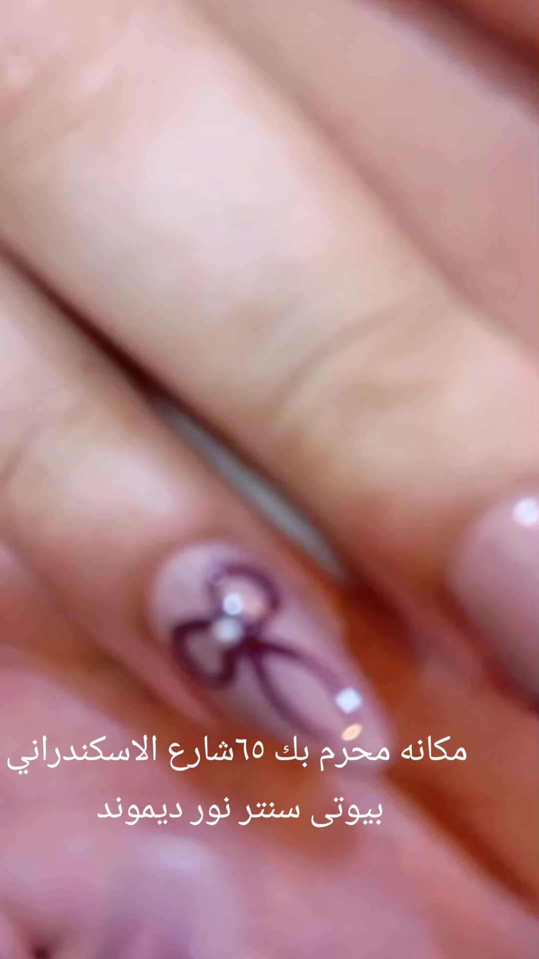 @Nour diamond ๐