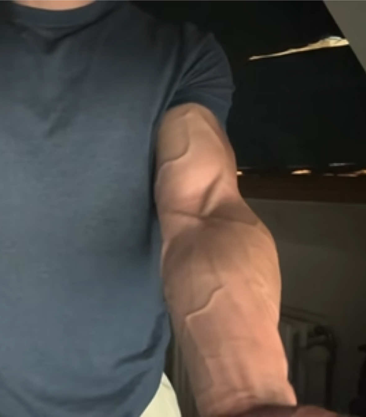 @ForearmWizard💪