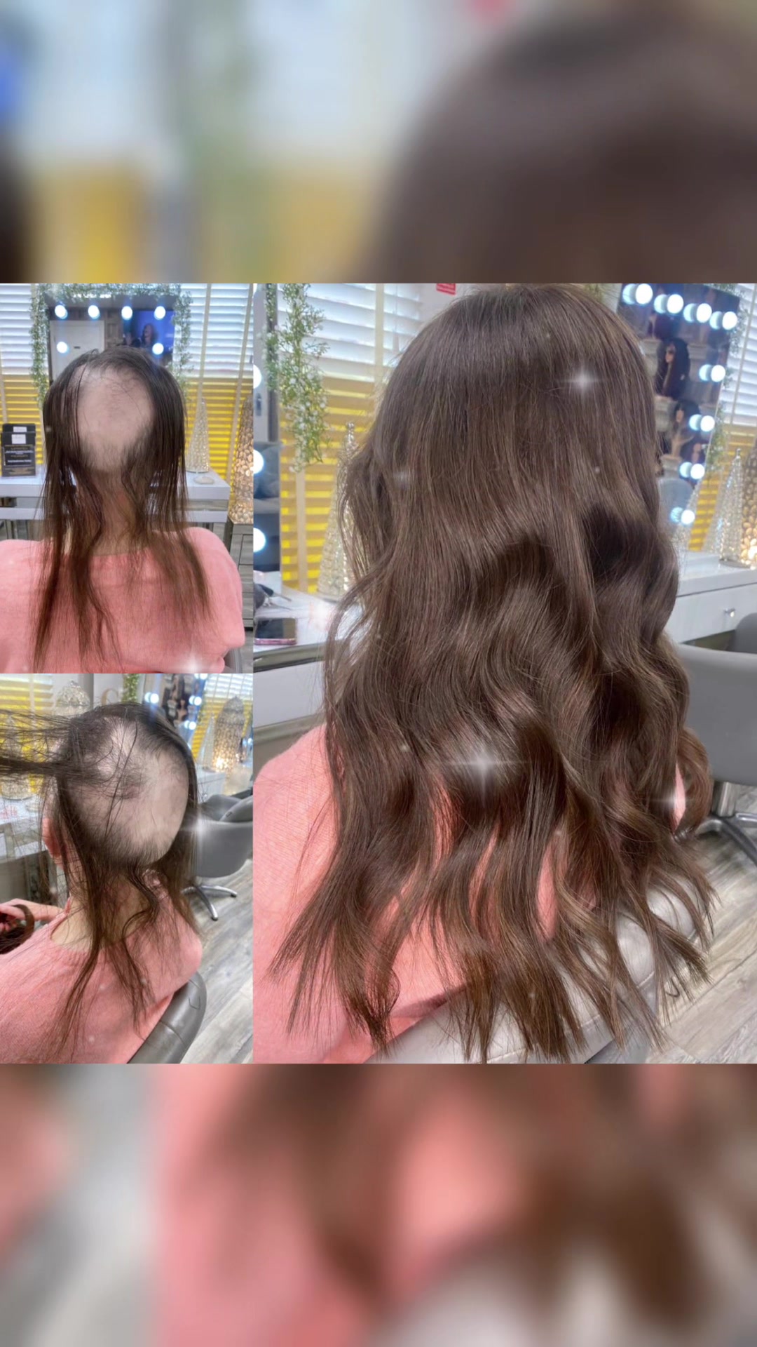 @Godiva Hair Loss Specialists