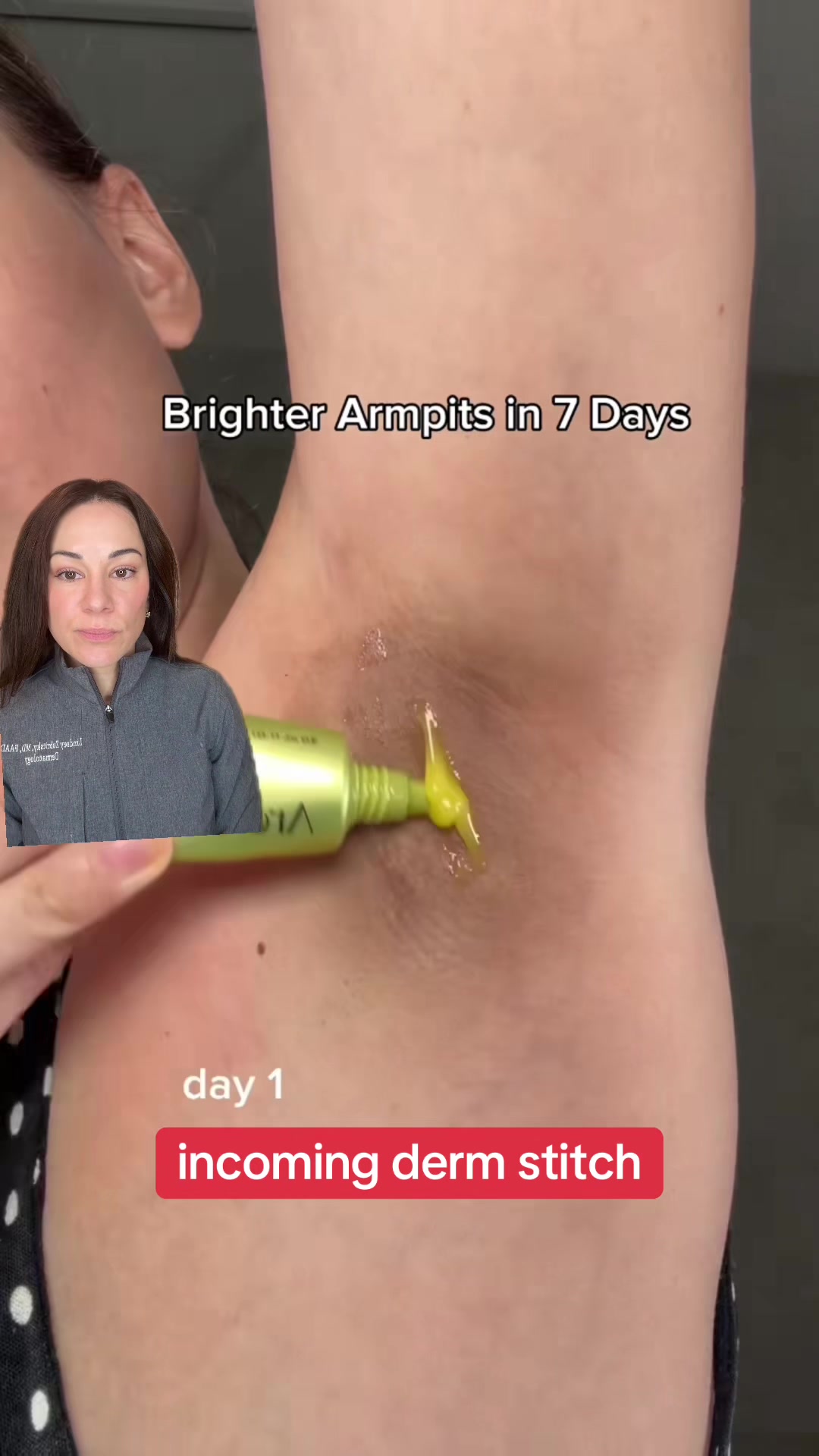 @Dermguru