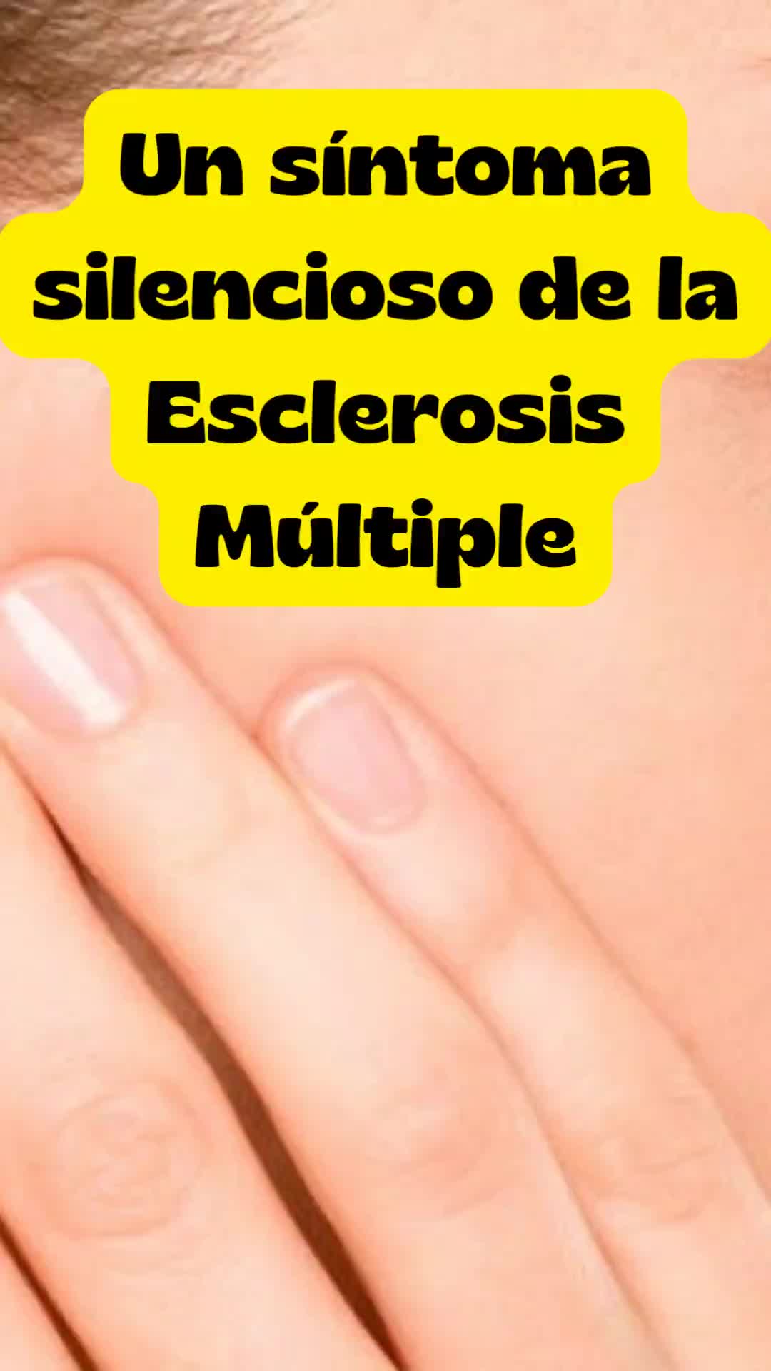 @Entendiendo la EM