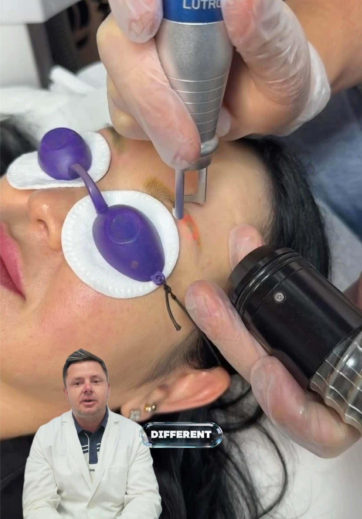 @Safe Eyebrows Tattoo Removal🗽