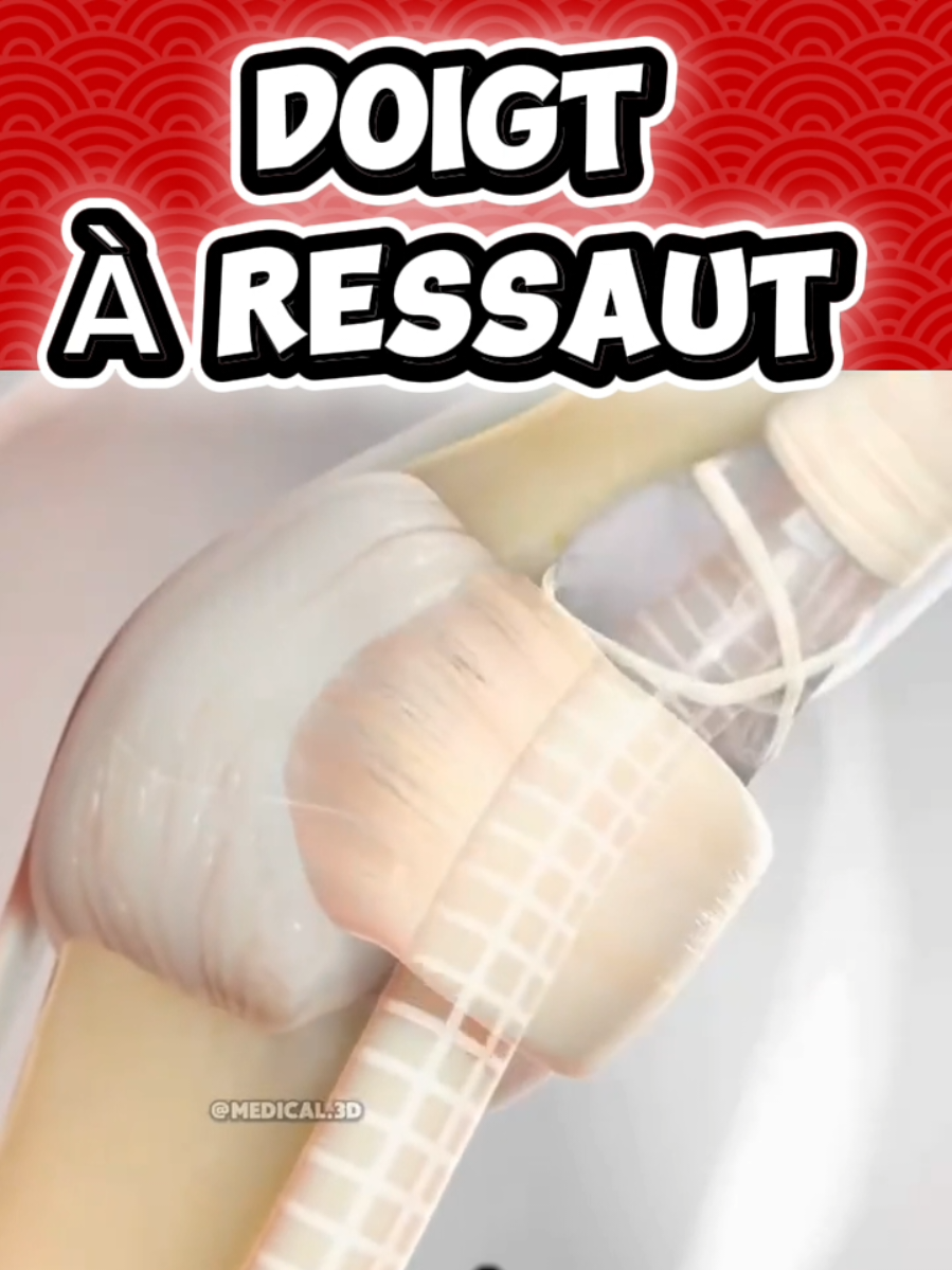@Docteur Shepherd