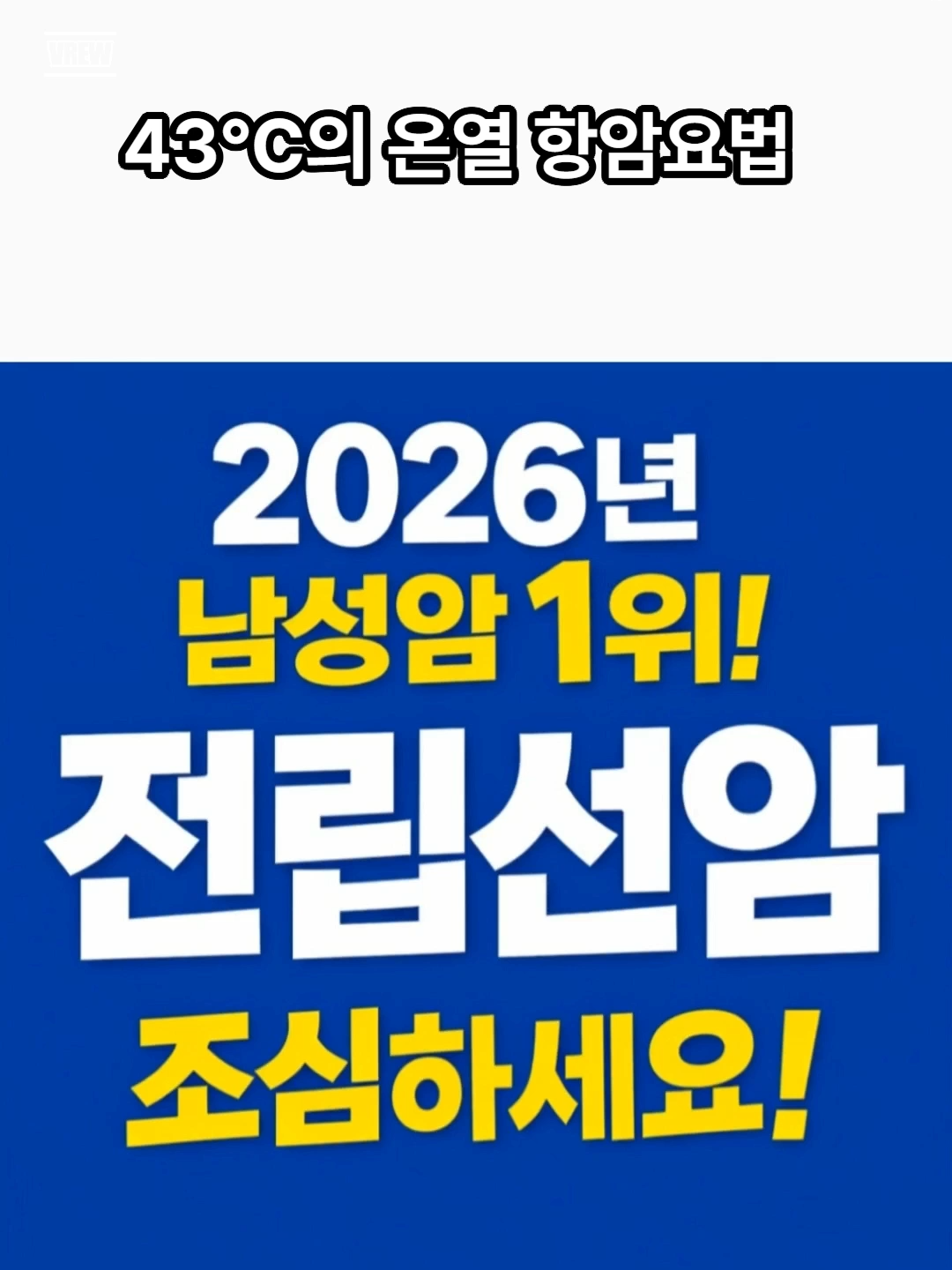 @전립선치료기 J2V