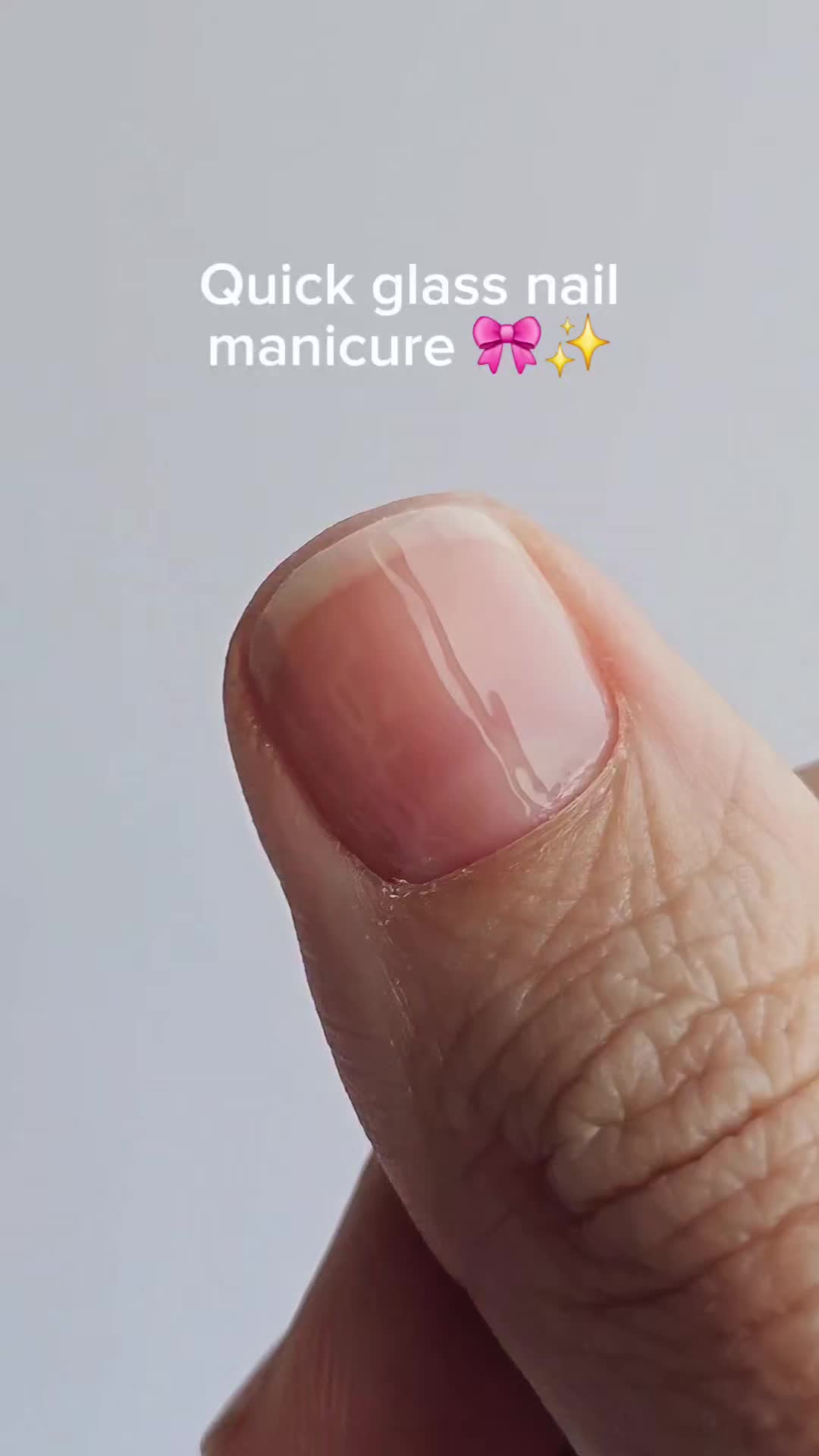 @Anna