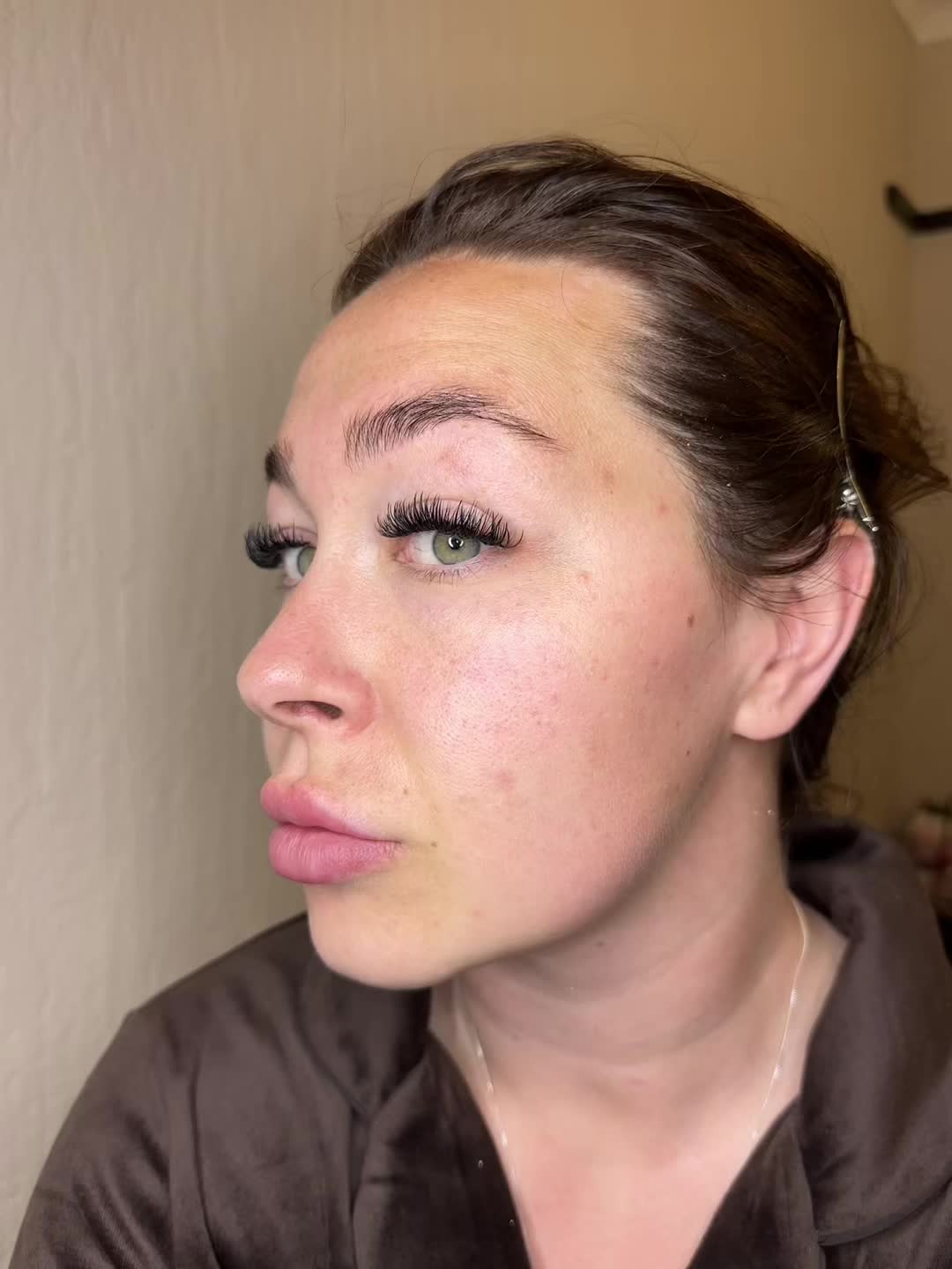 @almslawson