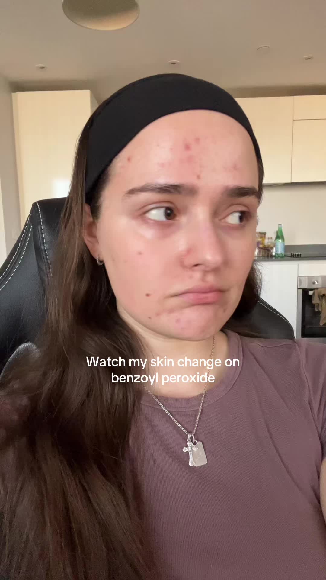 @andreea_skintok