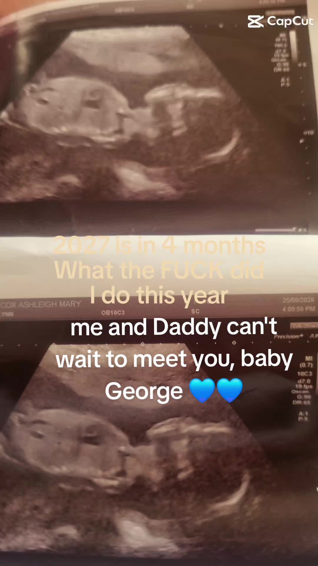 @Ashleigh.teenmama2under2♡