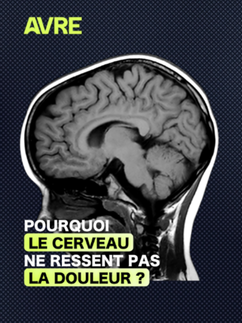 @AVRE