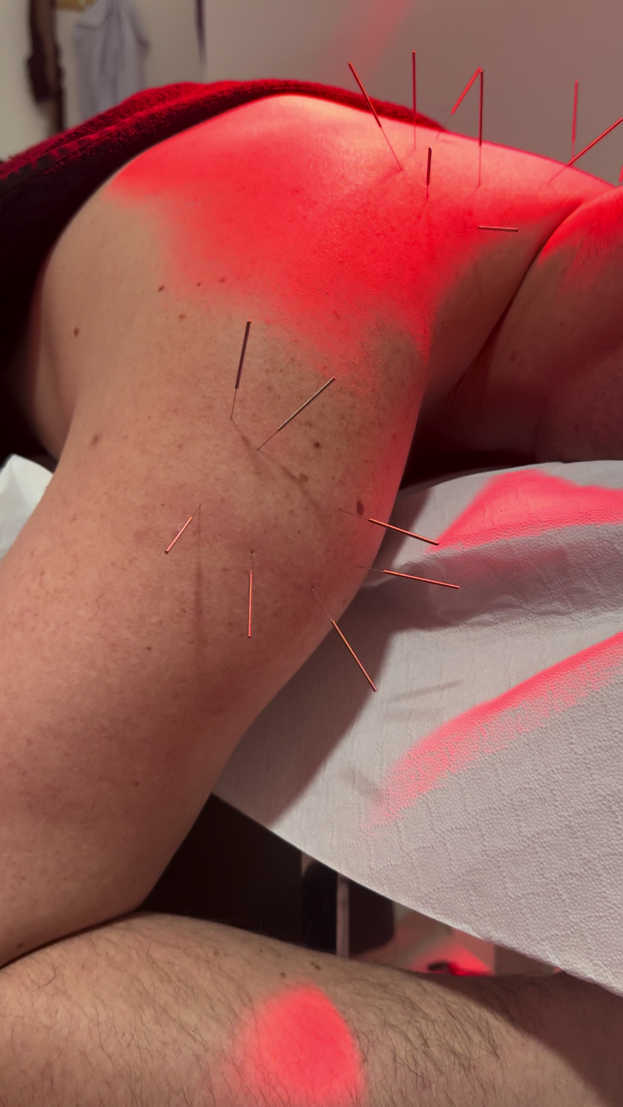 @FIZIOTERAPIA &ldquo;LUMI&rdquo;