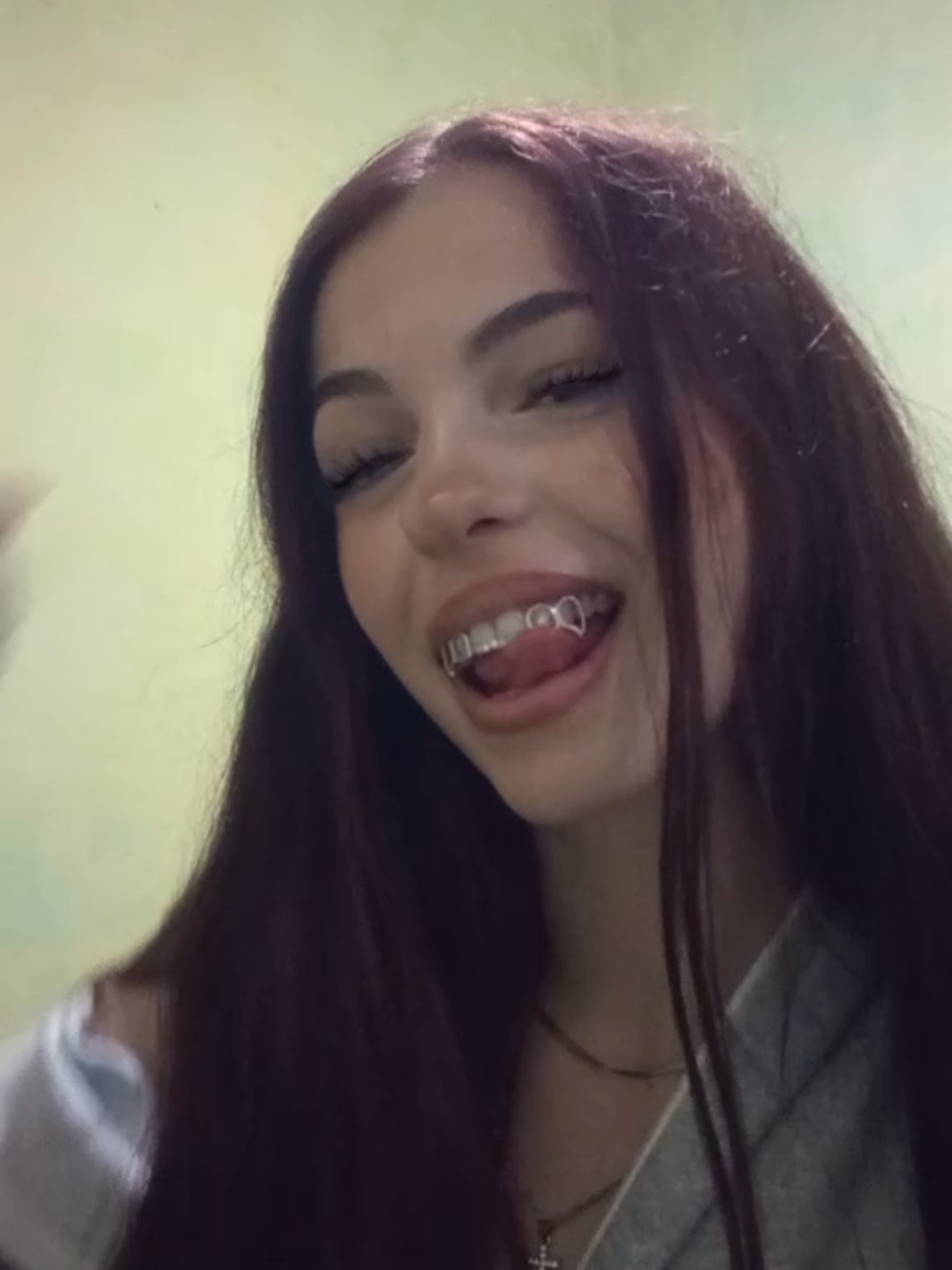 @vz_ana