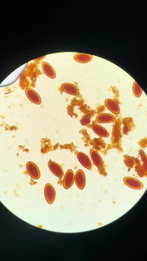@ALab 🔬💉🩸