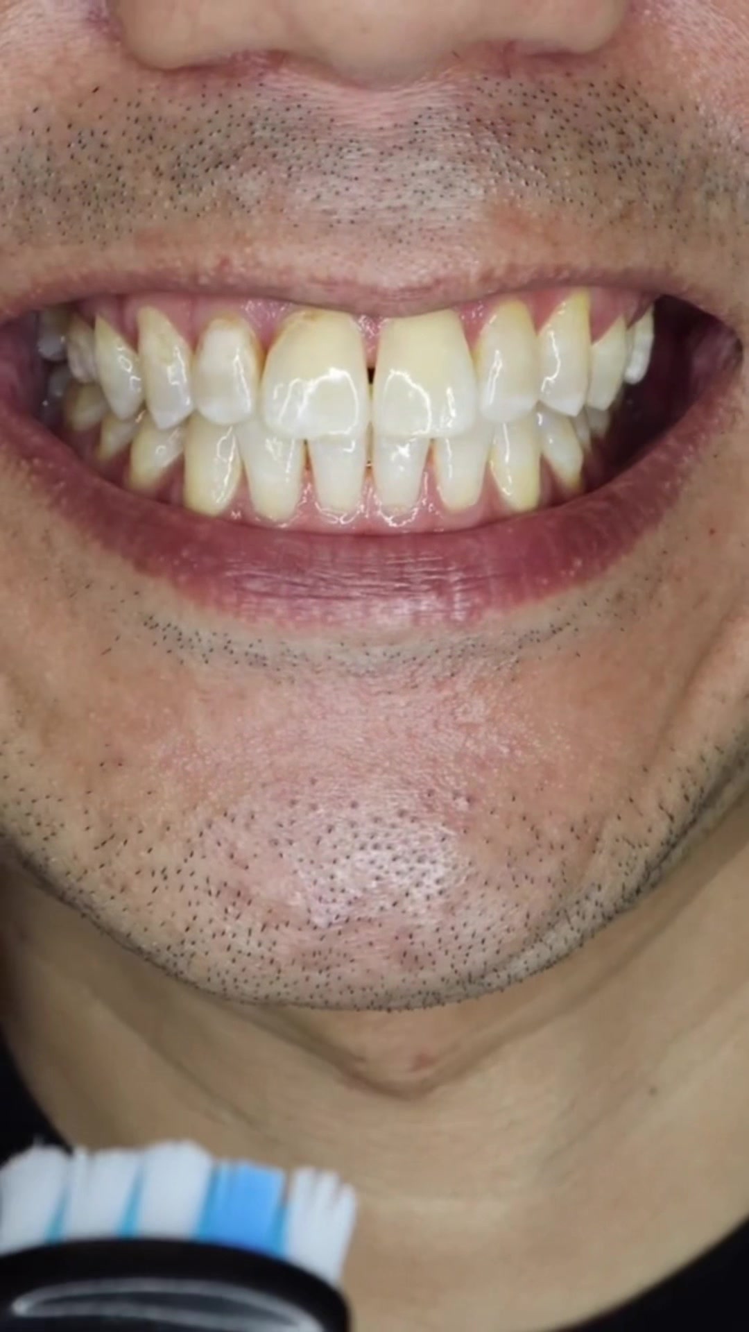 @Igienista dentale 🦷